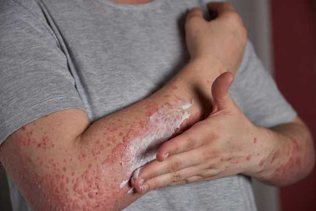 Аллергия и красные пятна на коже