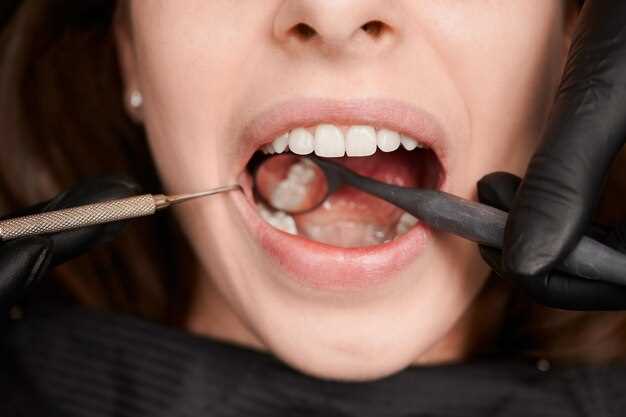 Здоровье зубов и профилактика белых пятен