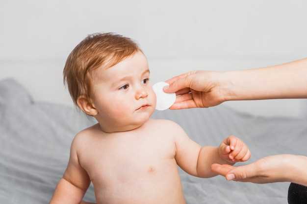 Как правильно лечить красные пятна на коже у ребенка?