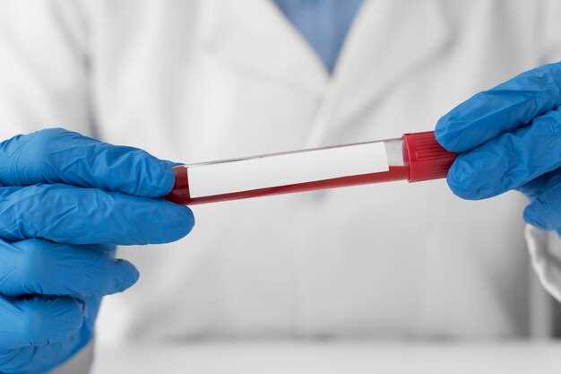 Диагностика ВИЧ-инфекции: изменения общего анализа крови