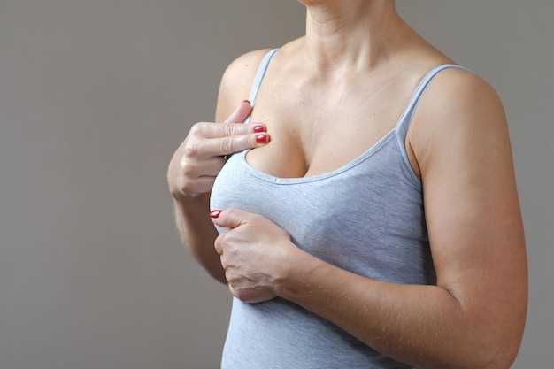 Зуд и покраснение под грудью: причины, симптомы и эффективные методы лечения